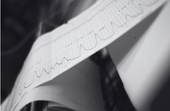 Fetal monitoring strip showing a clinical tracing in close detail